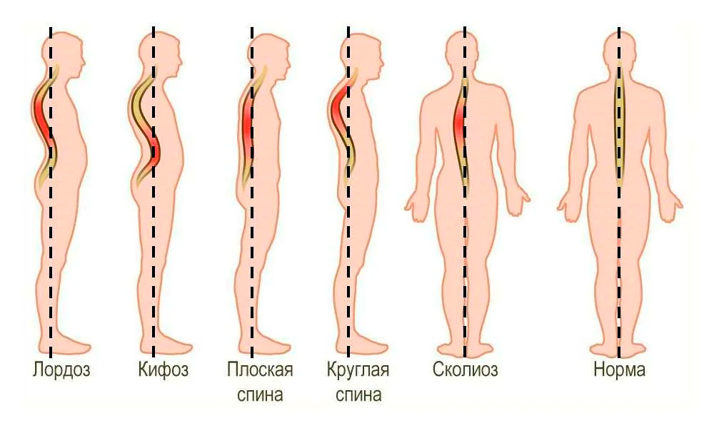 Что осанка говорит о характере: 4 типа личности, которые определяют по положению спины