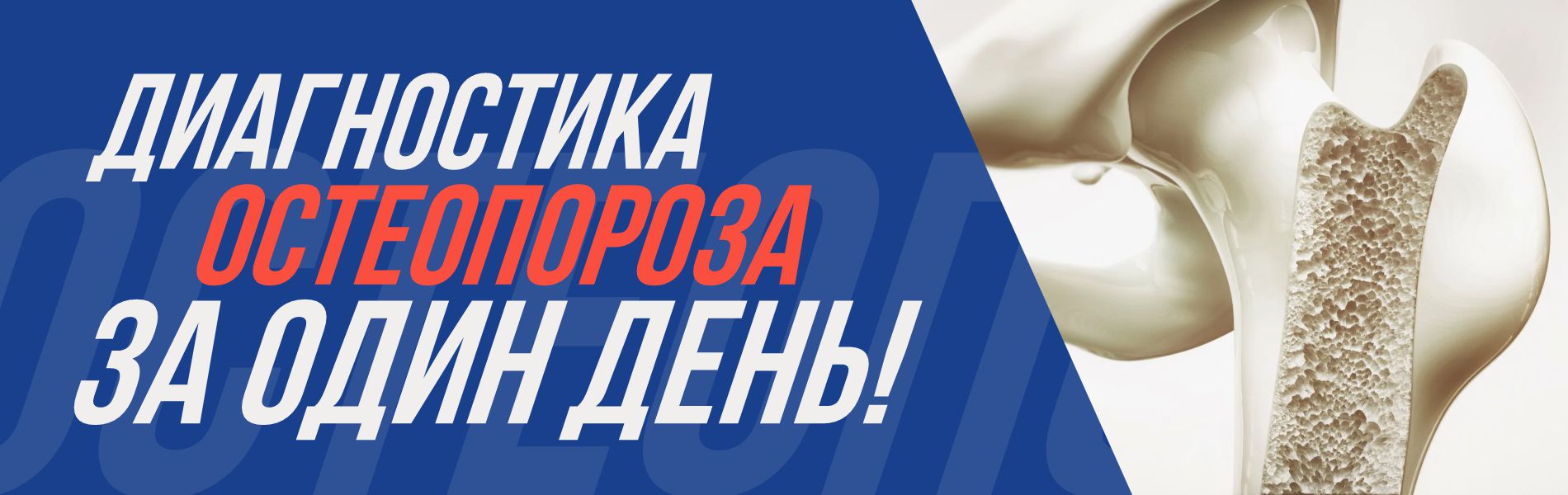 Диагностика остеопороза