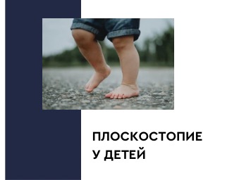 Плоскостопие у детей